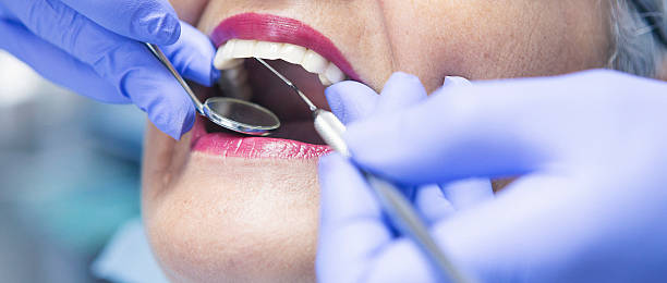 Best Emergency Dental Care for Broken or Chipped Teeth in Loris, SC
